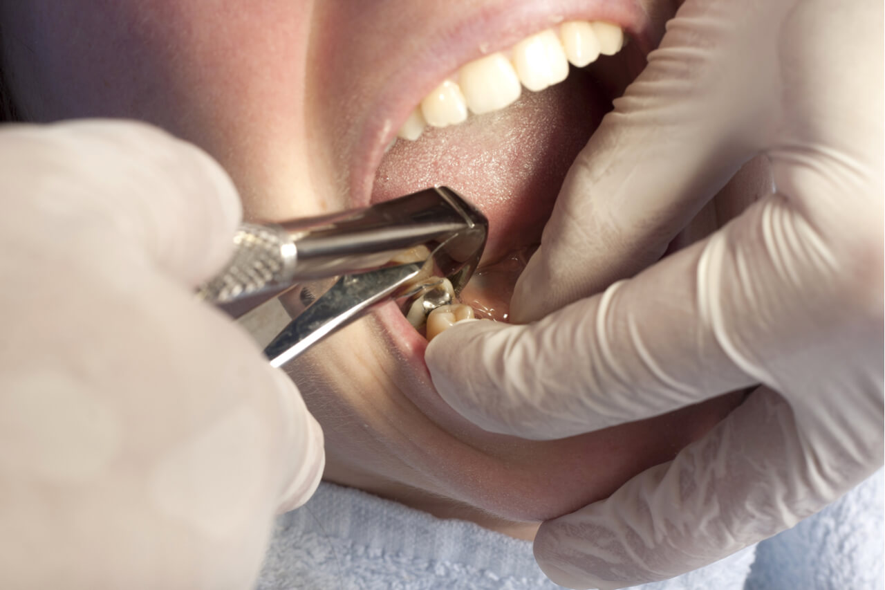 Хирургическая стоматологическая помощь